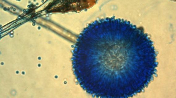 Aspergillus Mold Facts and Removal Tips